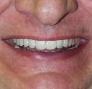 After treatment, result 3