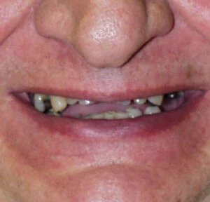 Before treatment, result 3