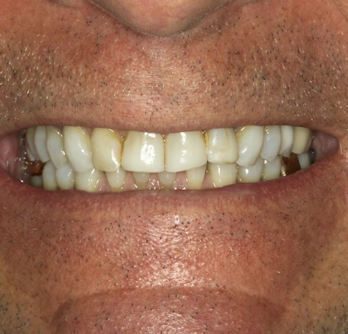 Before treatment, result 1