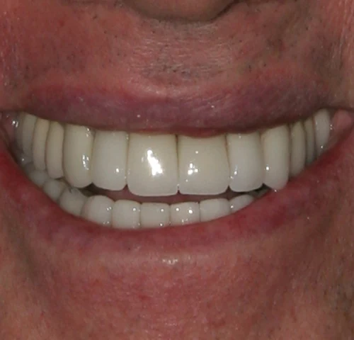 After treatment, result 2