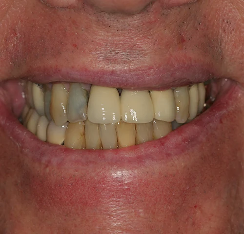 Before treatment, result 2