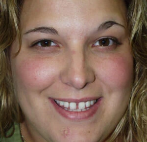 Before treatment, case 6