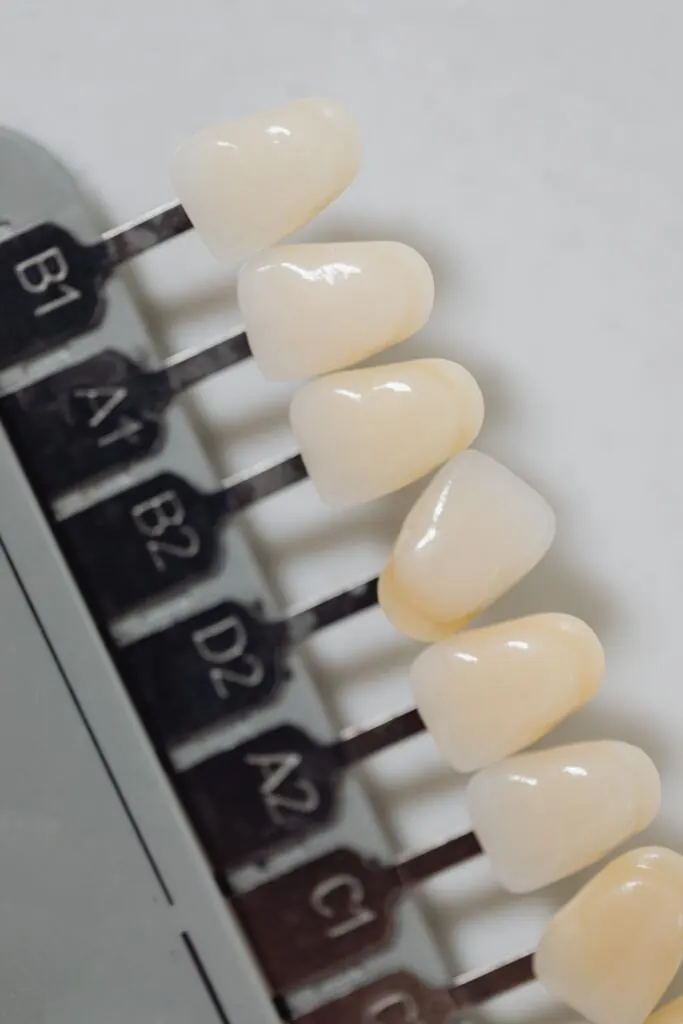 Porcelain veneer shades