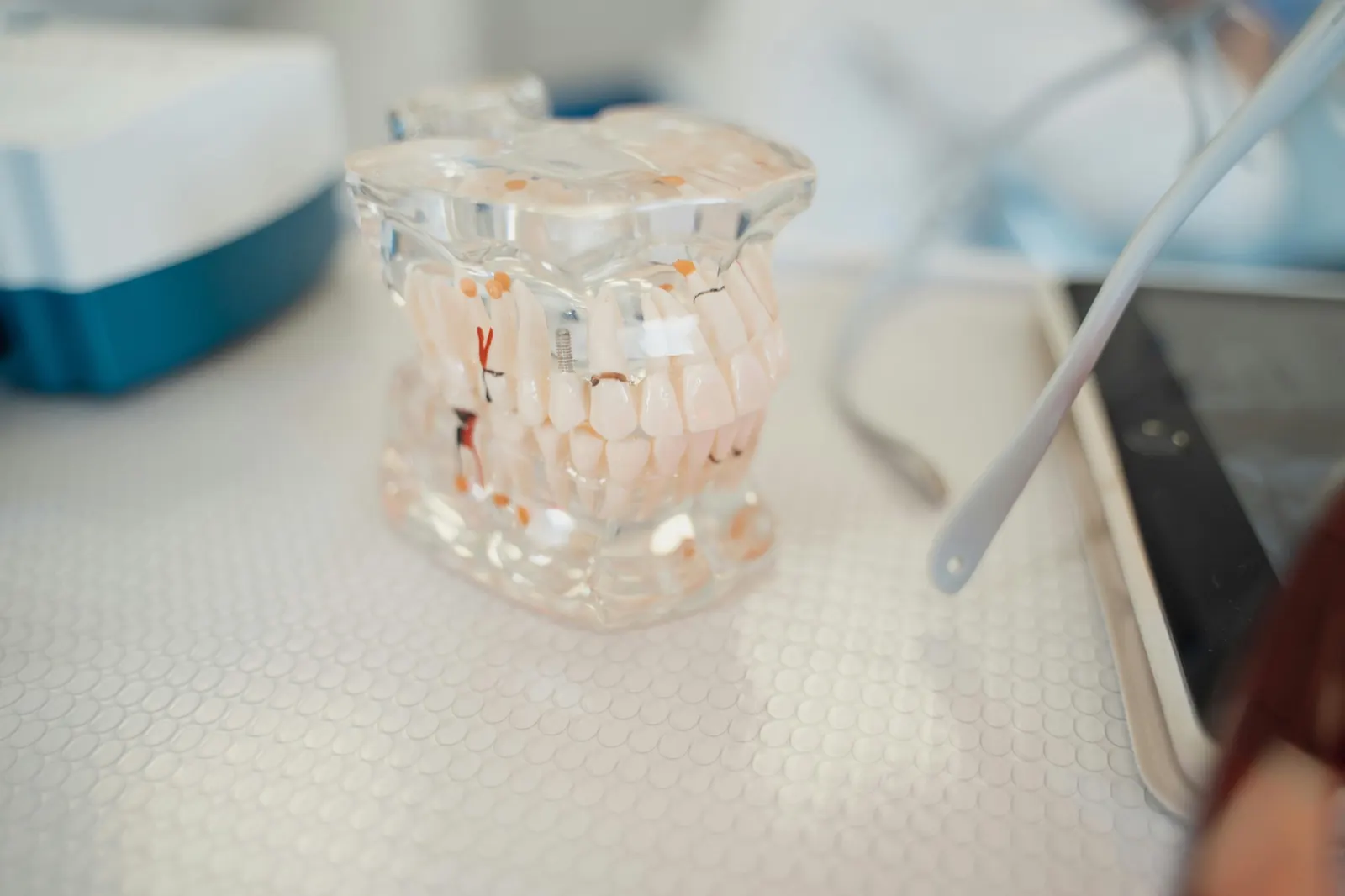 A clear model of the teeth on a clinic table