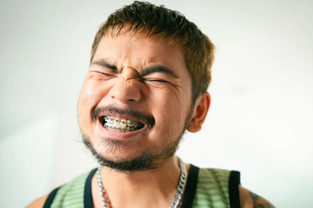 Close-up of a smiling man with braces, beard, and mustache expressing joy indoors.
