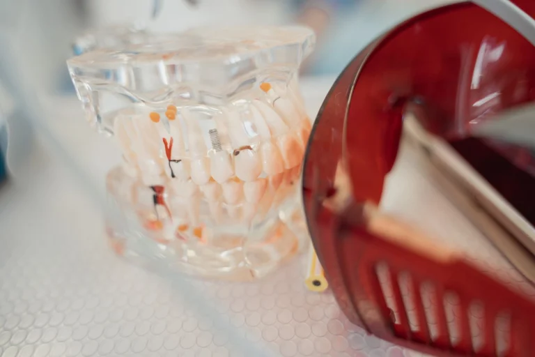 A dental model and red protective glasses on a textured surface, highlighting dental health tools.