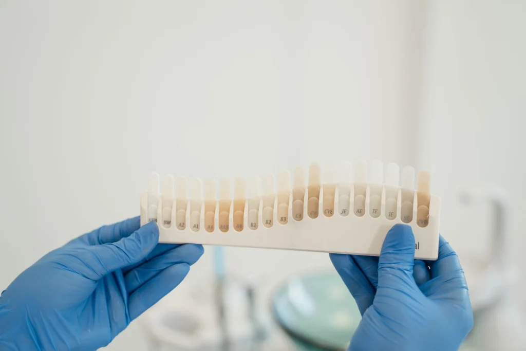 Dentist using a tooth shade guide to match patient's tooth color accurately during treatment.