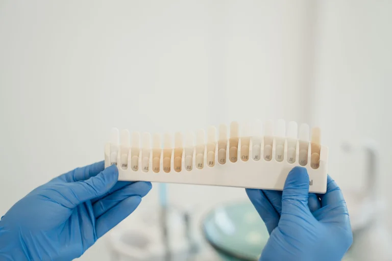 Dentist using a tooth shade guide to match patient's tooth color accurately during treatment.