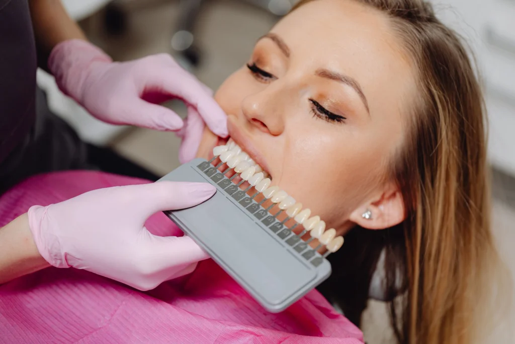 Dental shade guide being used to match tooth color during a hygiene procedure.