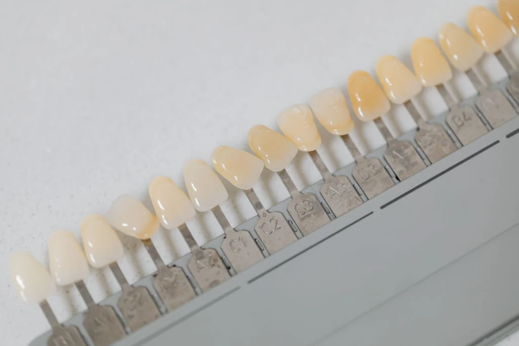 Close-up of a dental shade guide used for tooth color matching in dentistry.