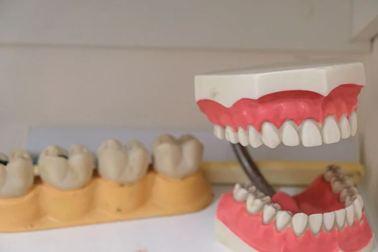 Close-up image showing detailed dental models and dentures on display, ideal for dental education.