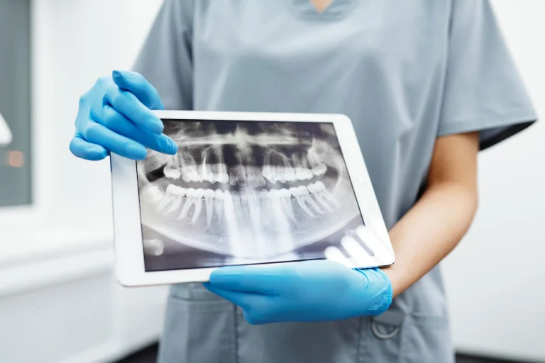 Dentist displaying a dental x-ray on a tablet for patient examination and diagnosis.