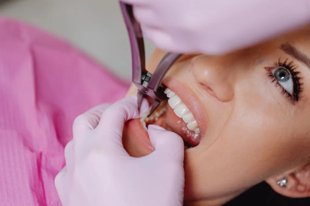 Close-up of dental procedure with patient and dentist, emphasizing oral healthcare.