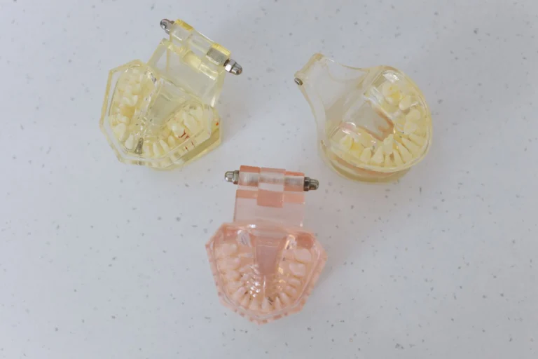 Three transparent dental models displayed on a white surface for educational purposes.