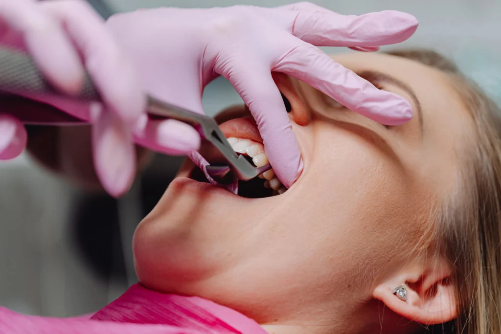 A patient receiving dental care, showcasing pink gloves and dental tools in a clinic setting.