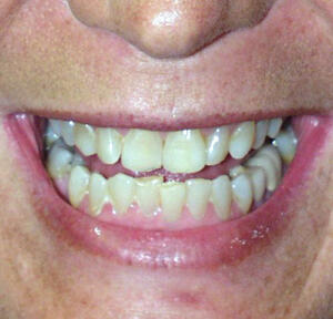 Before