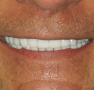 After