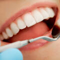 The Clear Choice: Why Invisalign in Timonium is the Modern Path to a Perfect Smile