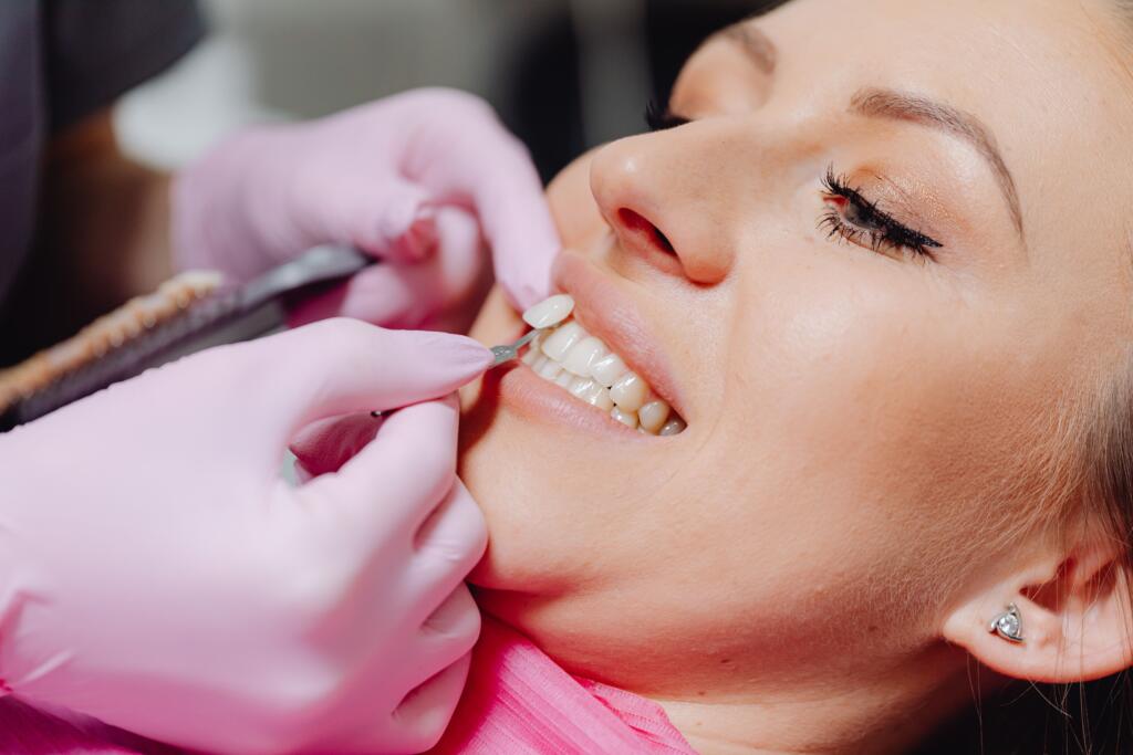 Prepless Veneers in Timonium, MD